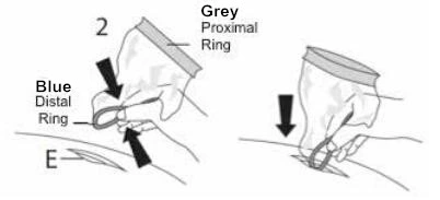 Disposable Wound Retractor for Laparoscopic Surgery